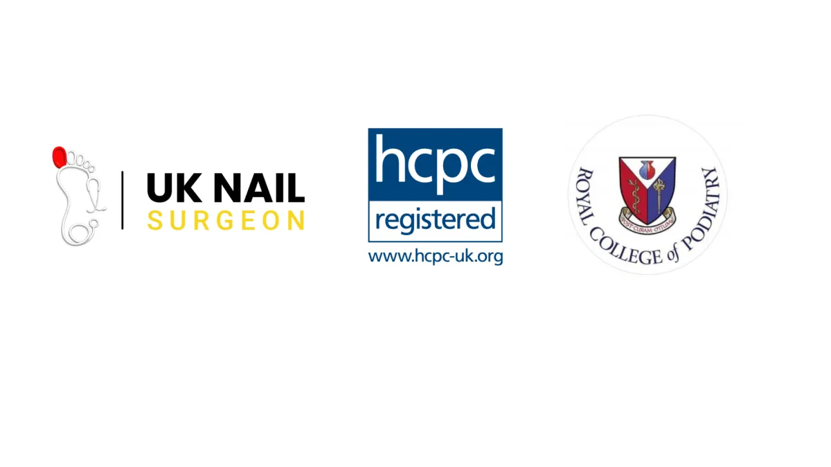 ingrown toe nail solution