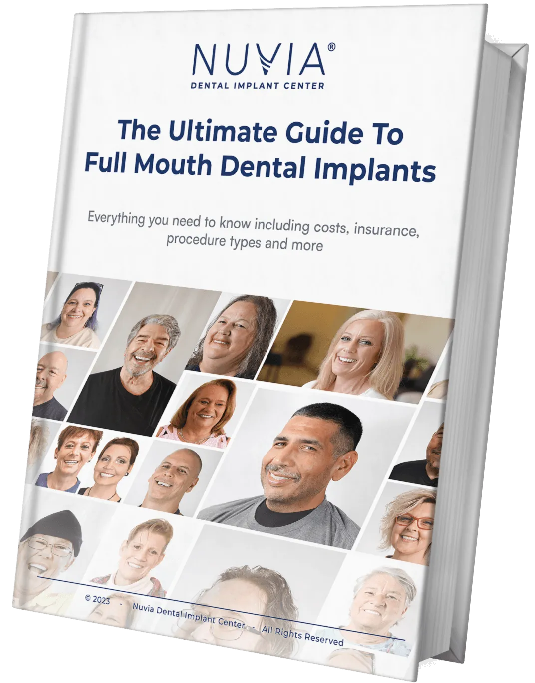 The Ultimate Guide To Full Mouth Dental Implants In 2024   63b84b864103f23bcc441362 