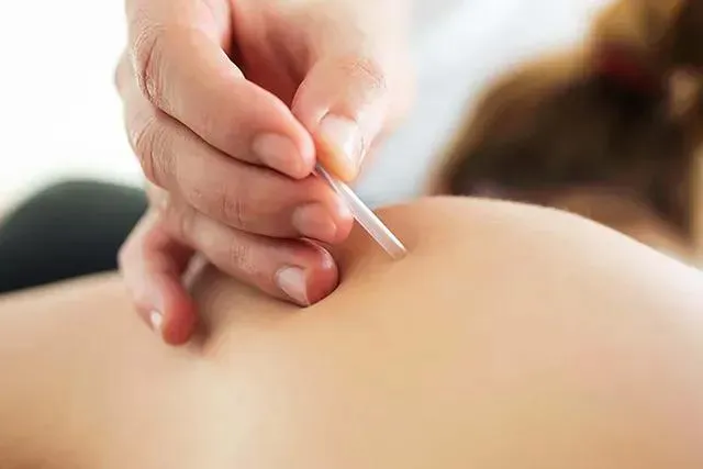 Trigger Point Injection