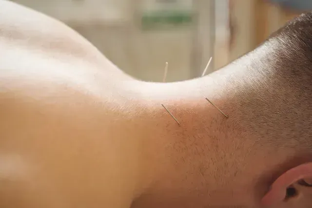 neck acupuncture