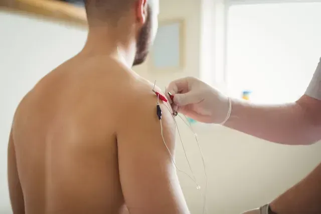 Acupuncture on man