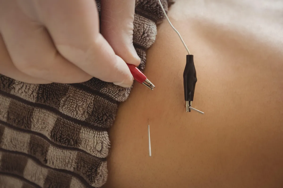 Acupuncture for Shoulder Pain in Clifton, NJ