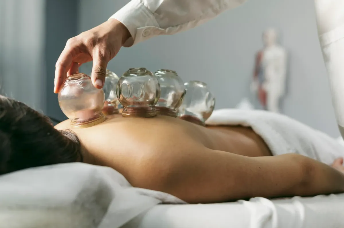 Cupping Therapy in Clifton, NJ