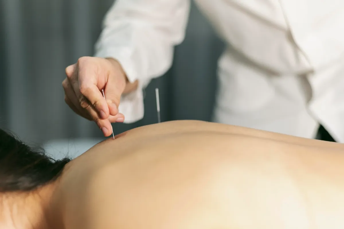 Acupuncture for Shoulder Pain in Clifton, NJ