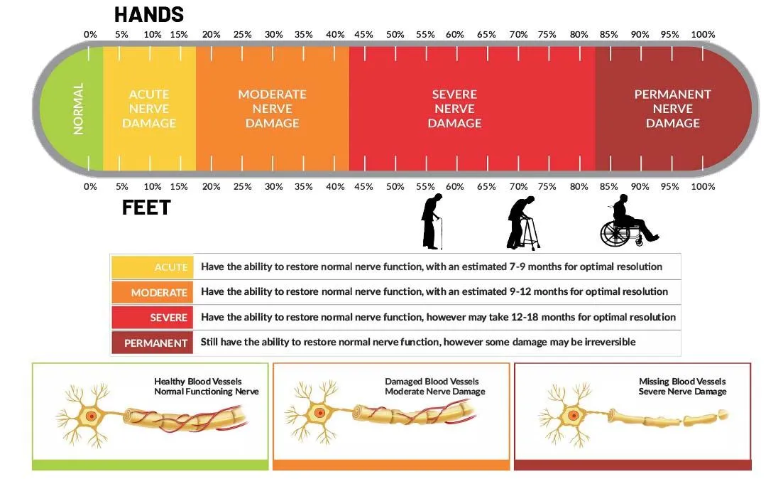 Neuropathy Nerve Damage Stages Chart