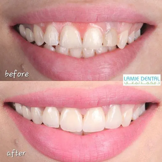 Techno Viz  -  Lamie Dental Centers