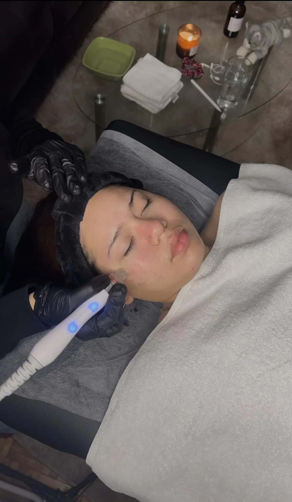 Meilleur Hydra facial Montréal Pas cher