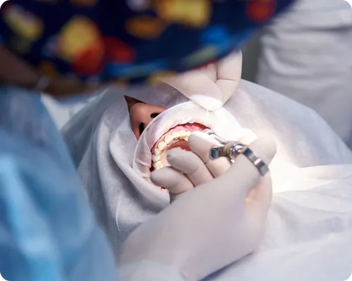 Dental Malpractice