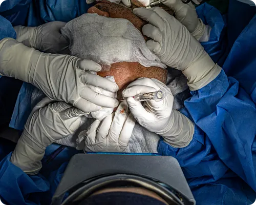 Surgical Errors