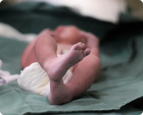 Birth Injuries