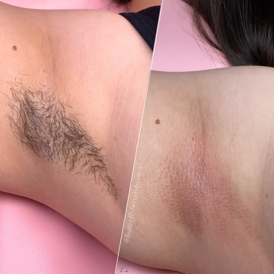 Full Body Waxing