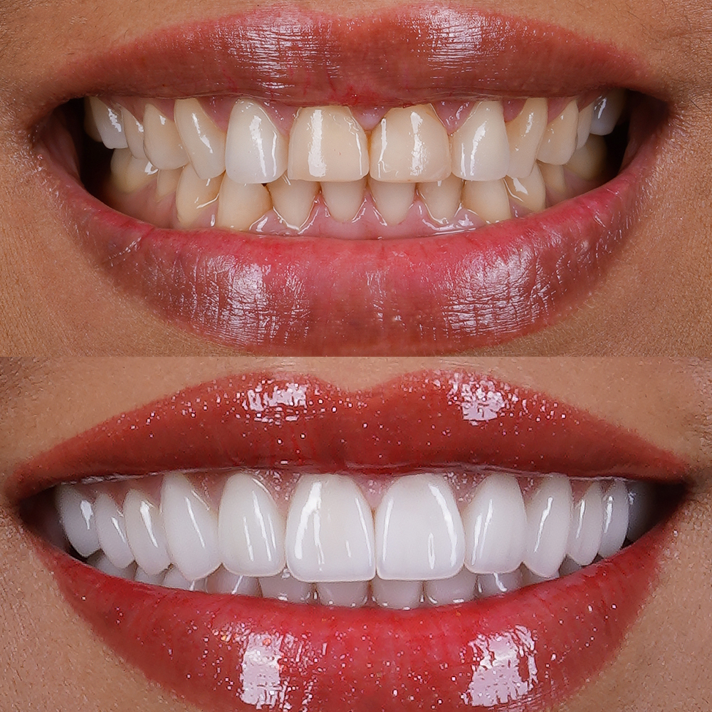 A bathroom mirror with a reflection of a fish in it