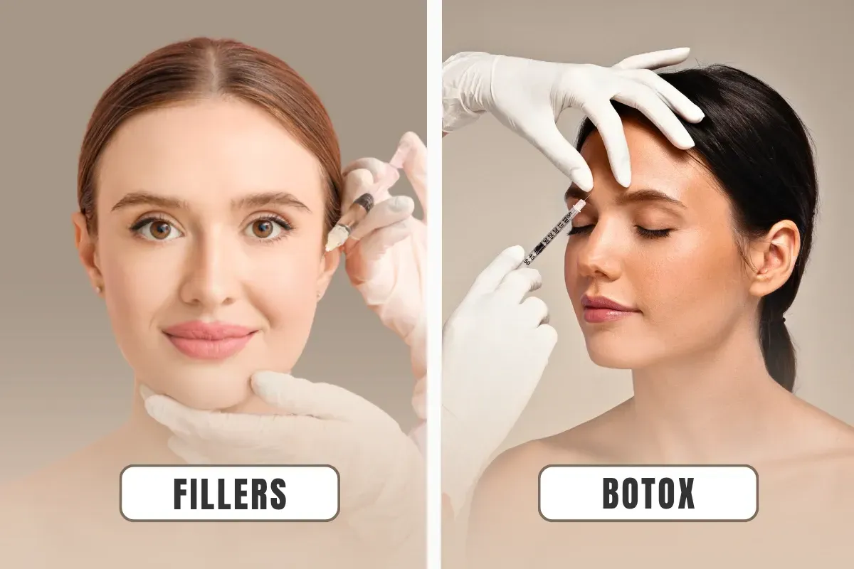 Dermal fillers vs Botox treatment comparison