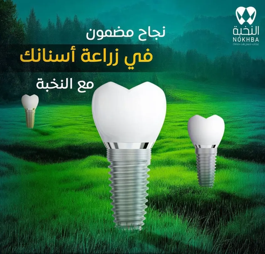 زراعة الأسنان ببريدة | تقنية زراعة الأسنان الفورية | مجمع ومعمل النخبة لطب الأسنان ببريدة