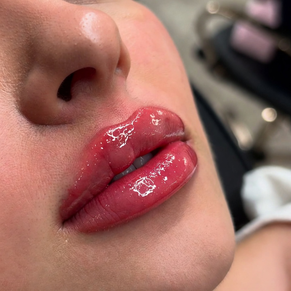 Labios hidratados con demapen