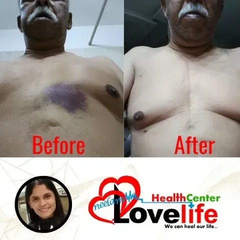 Patient Transformation 3