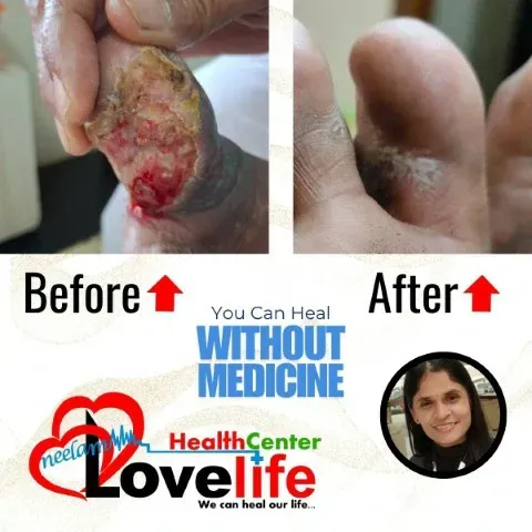 Patient Transformation 1