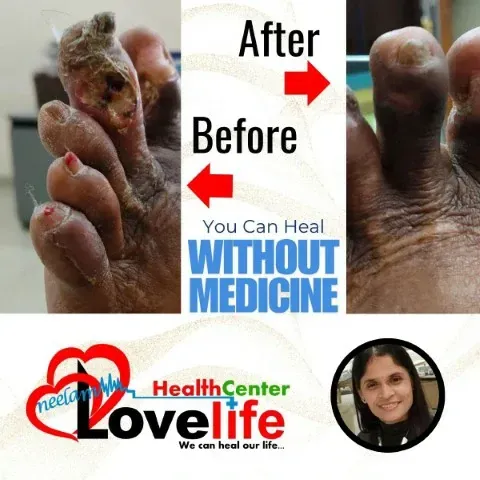 Patient Transformation 4