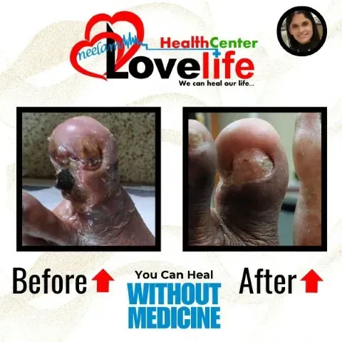 Patient Transformation 2