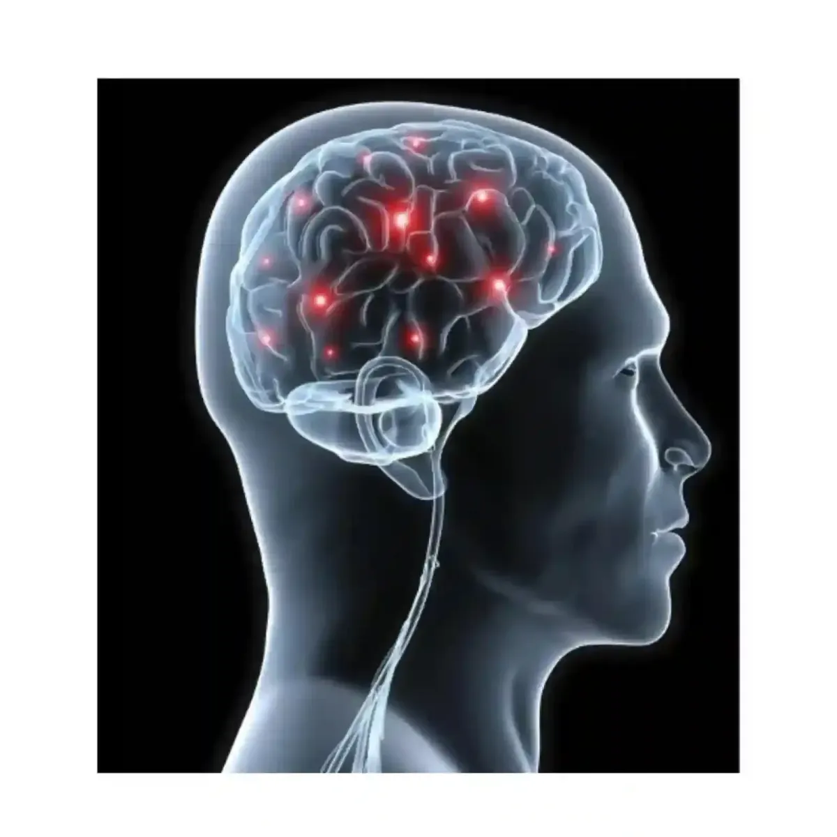 Mind Vault memorysupplement