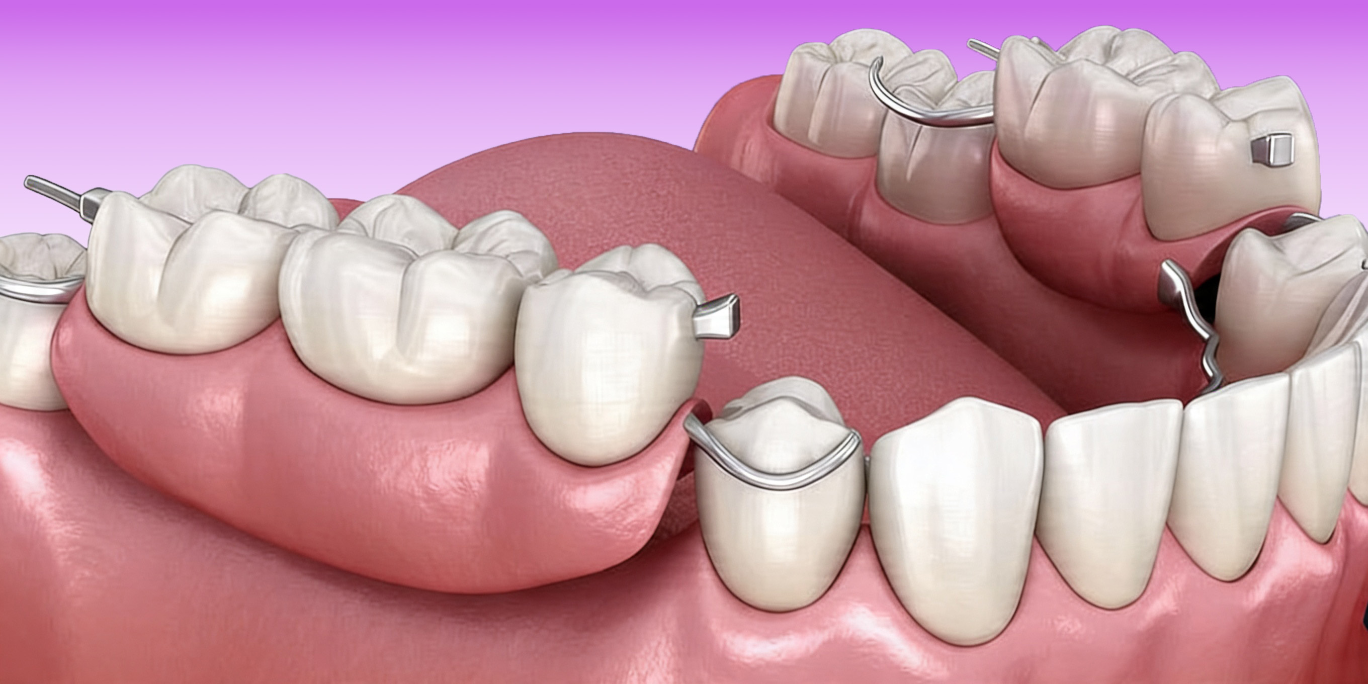 dentures in alor setar