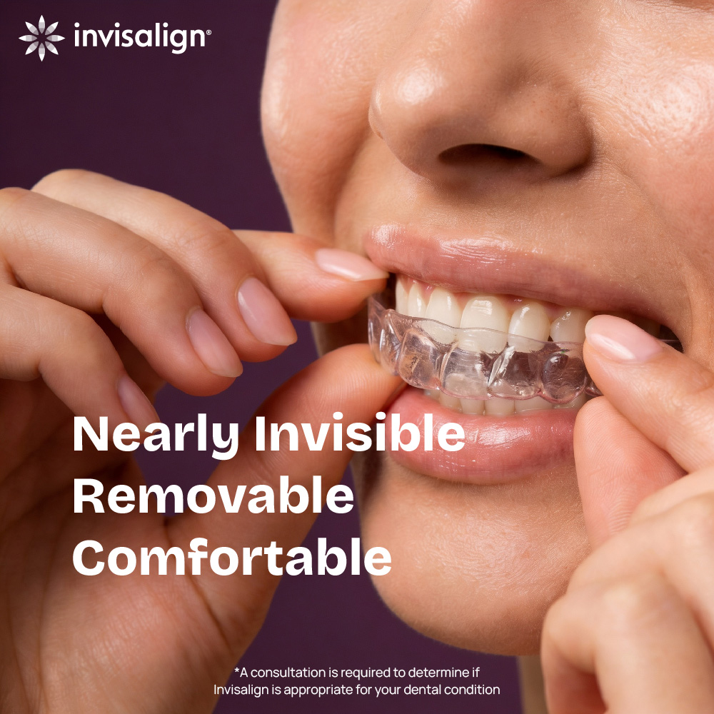 clear aligners invisalign in alor setar