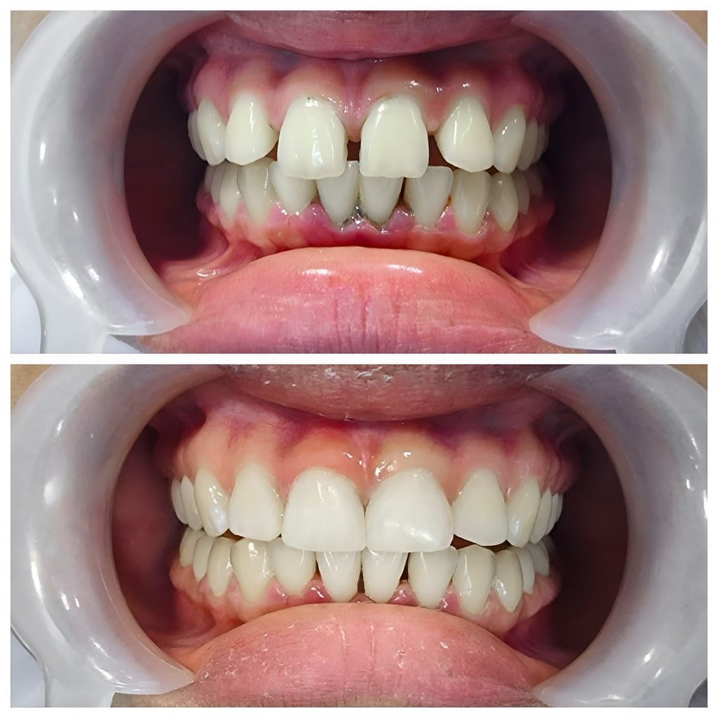 dental