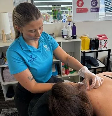 Physio doing dry needling