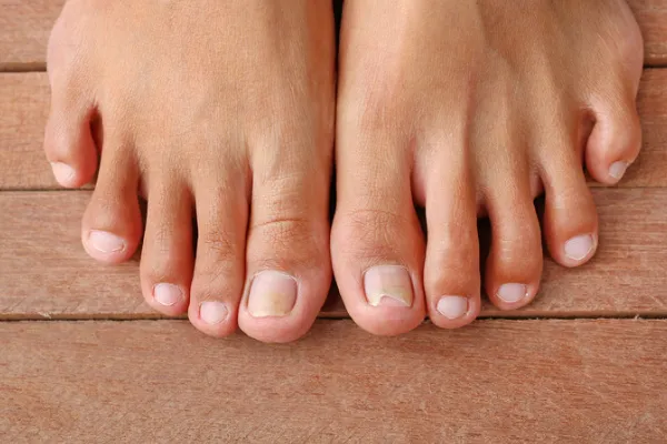 What Your Toenails Could Be Telling You About Your Foot Health