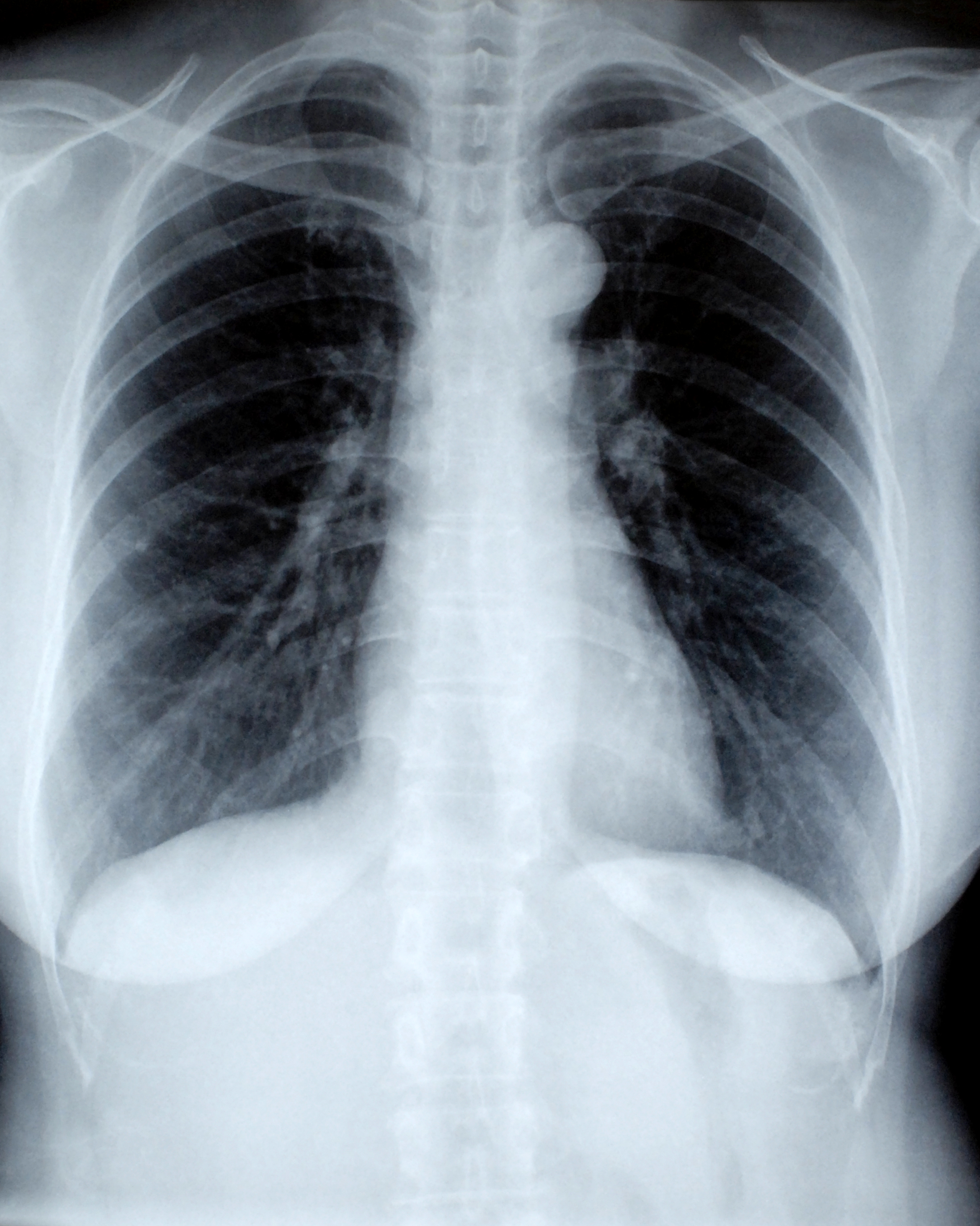 Soft-focus clinical setup for immediate on-site diagnostic imaging