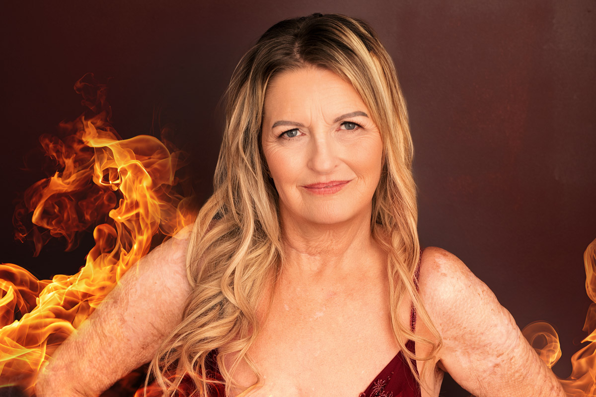 Portrait of Regina surrounded by flames - symbolic of her story of survival.