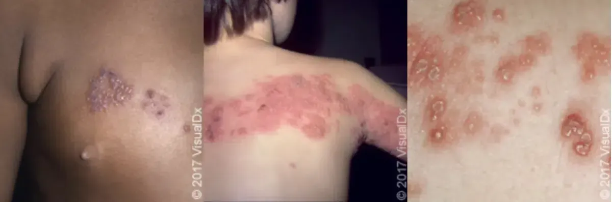 kids with skin rashes