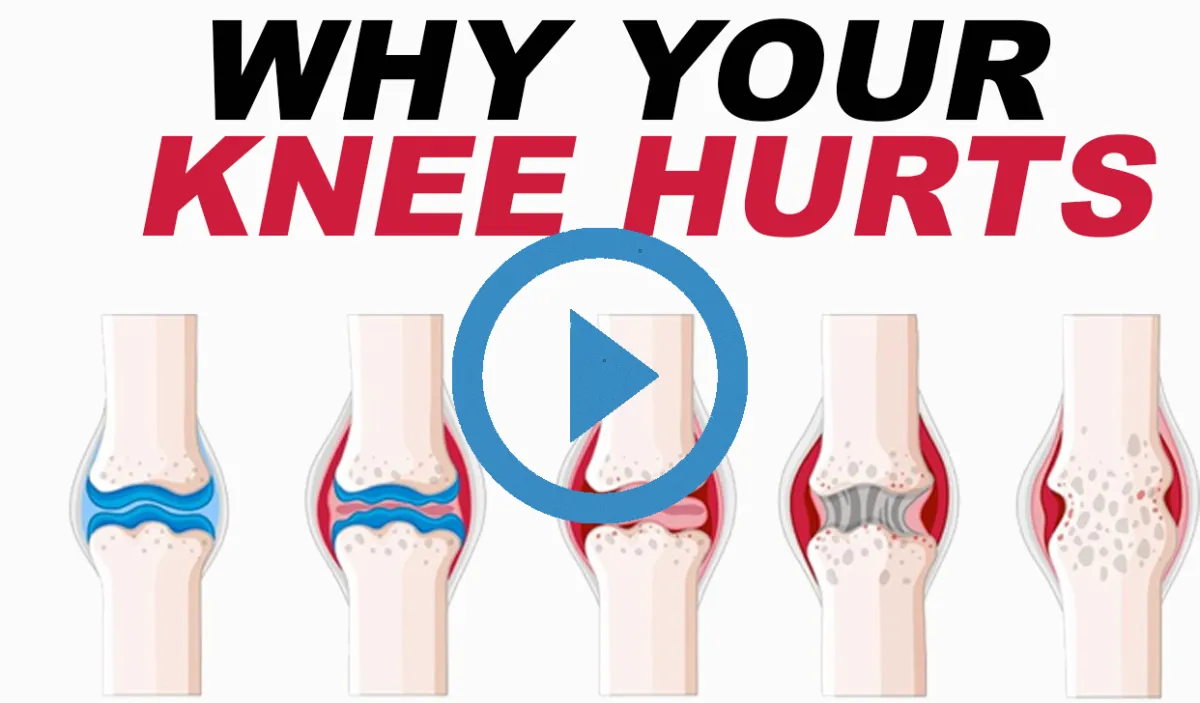 Why Your Knee Hurts