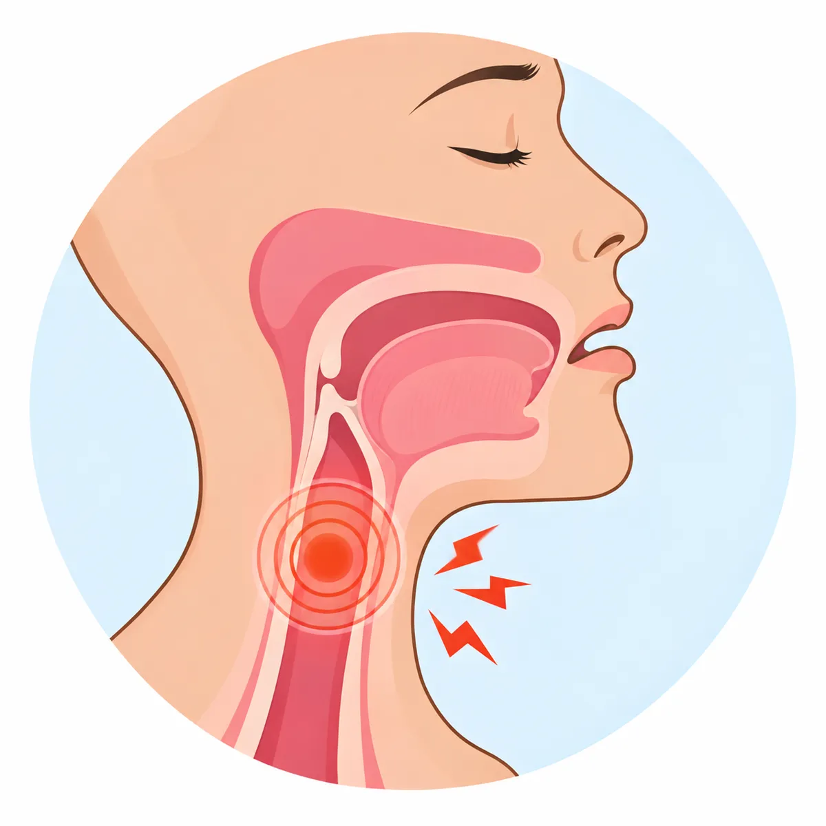 Can Swallowing Recover After a Stroke?