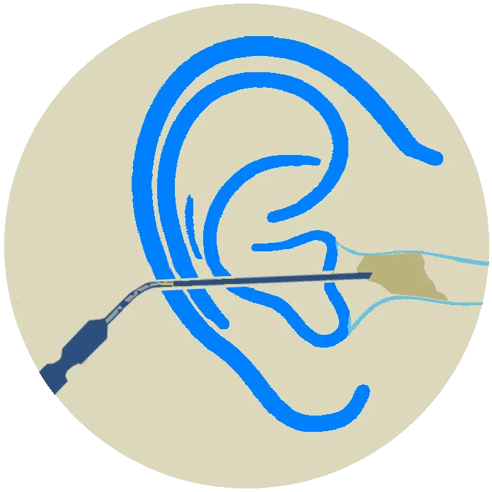 Earwax Removal Wagga Albury Wodonga Cobram Corowa Corryong