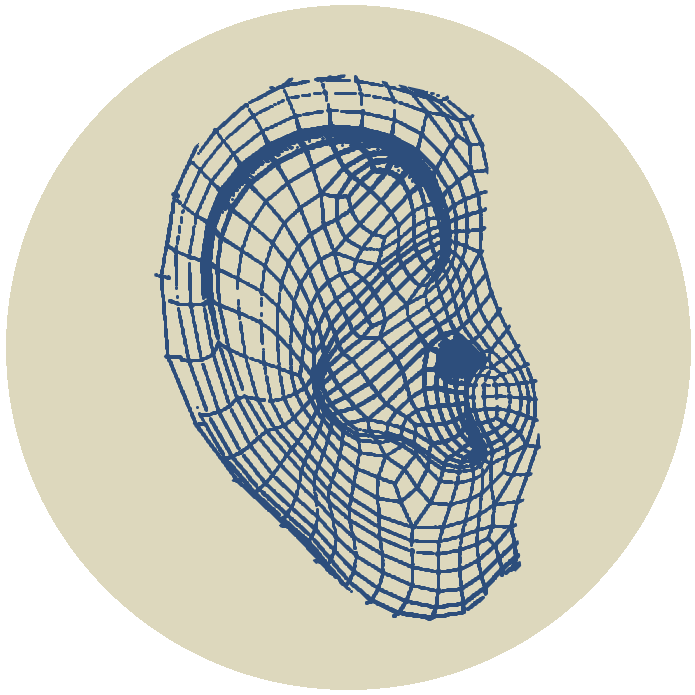 3D Ear Scanning Wagga Albury Wodonga Cobram Corowa Corryong