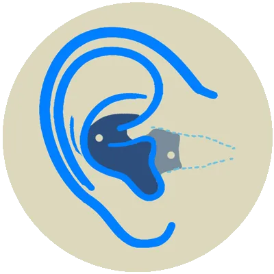 Custom-fitted Earplugs Wagga Albury Wodonga Cobram Corowa Corryong