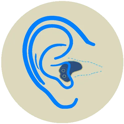 Hearing aid  - Wodonga, Wagga, Albury, Cobram, Corryong, Corowa