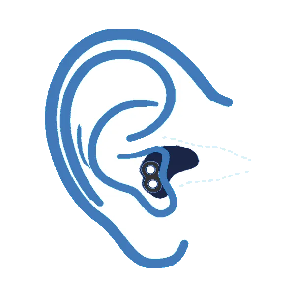 Hearing Aids Sydney Eastern Suburbs and Bowral