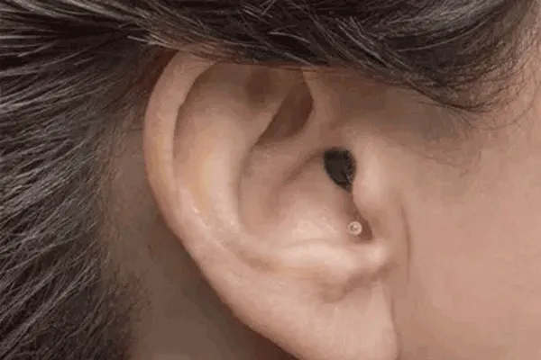invisible hearing aids