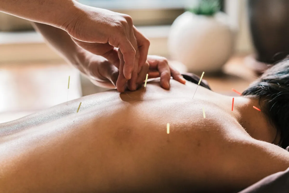 Does Acupuncture Actually Make Chiropractic Adjustments Last Longer? 