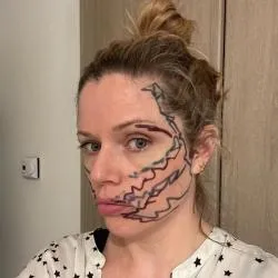 woman with jagged lines drawn on her face, showing where her trigeminal nerve pain constantly aches in her face. She is side on to the camera and has her hair tied up.