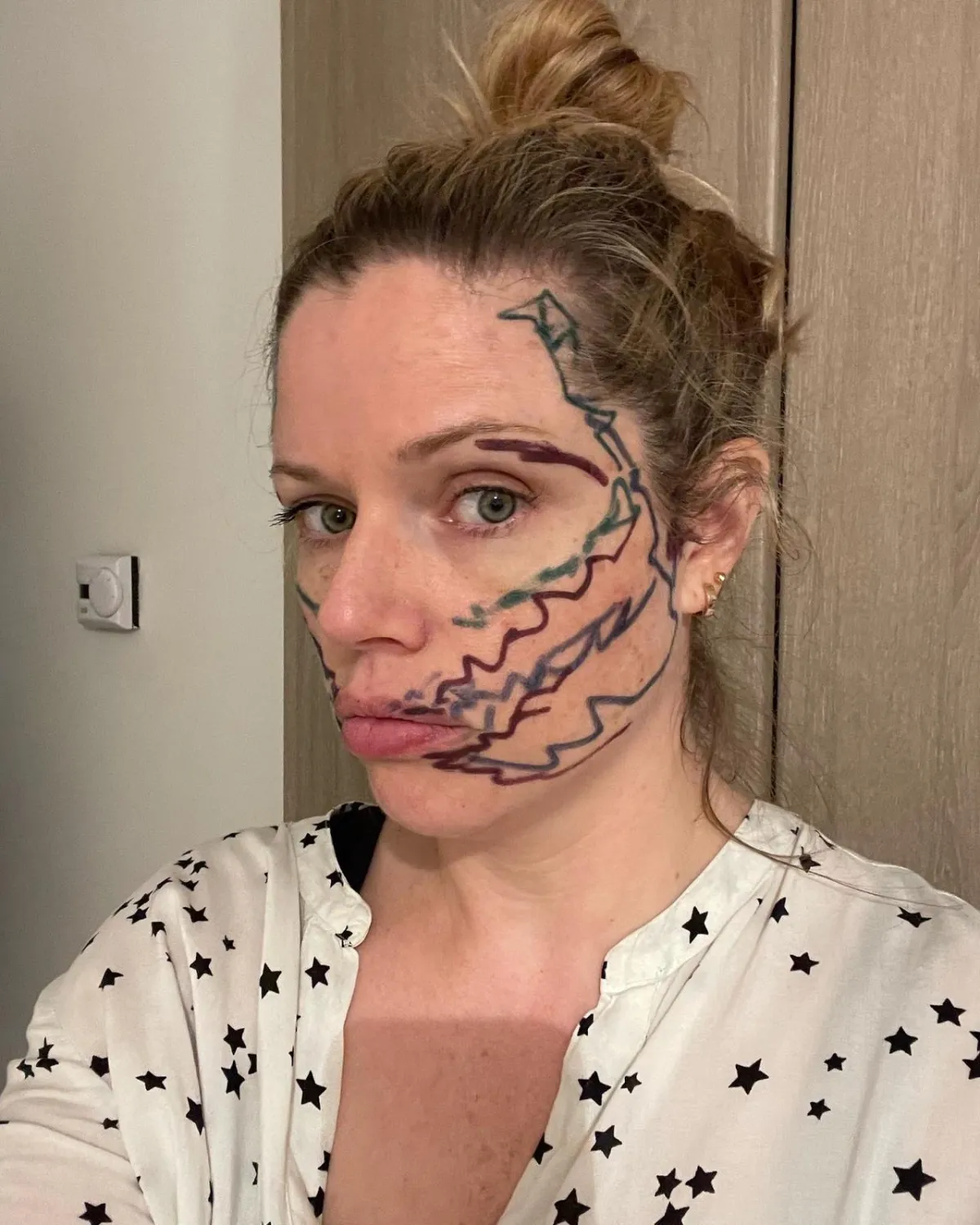 i am Laura business coach for ambitious women with health conditions. Laura with the lines drawn on her face as a visual representation of the facial pain she endures.