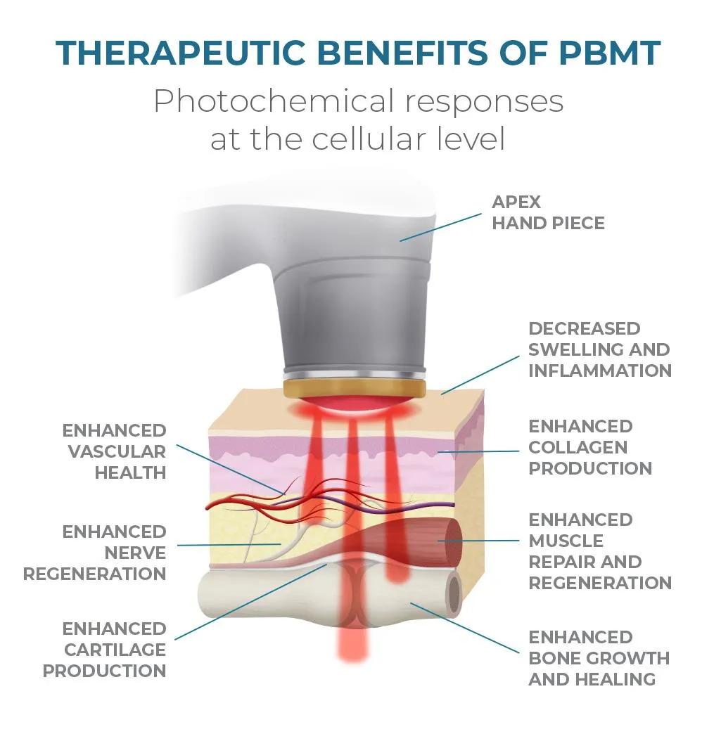 graphic illustration of photochemical response to laser at the cellular level