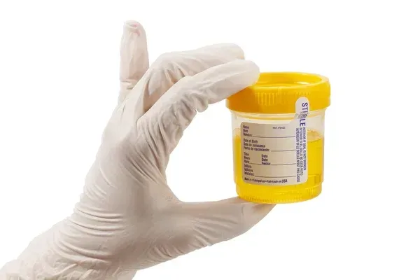 Specimen collection cup in a gloved hand