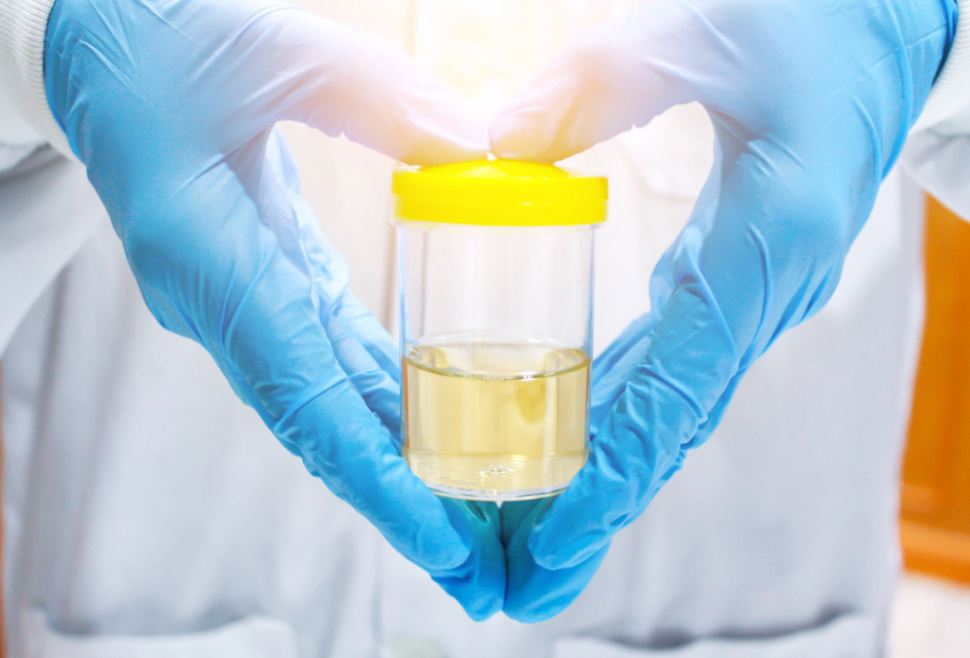 Specimen collection cup held in gloved hands