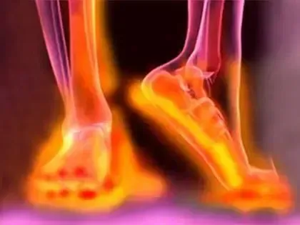 Image foot pain
