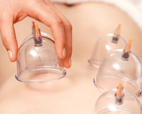 Cupping Massage Therapy in Edmonton