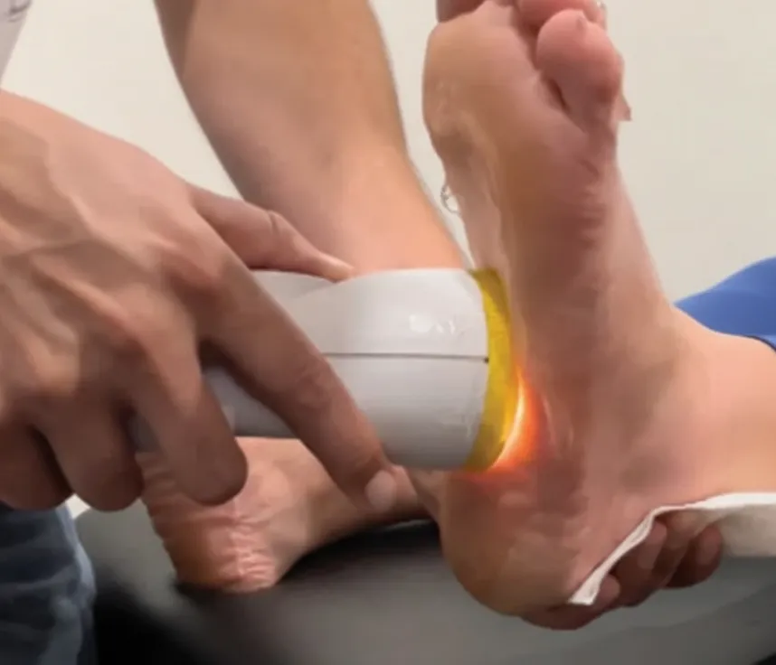 Plantar Fasciitis Pain
