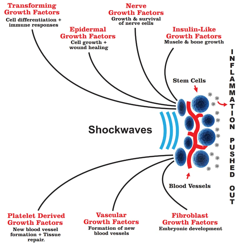 How Does SoftWave Therapy Work?